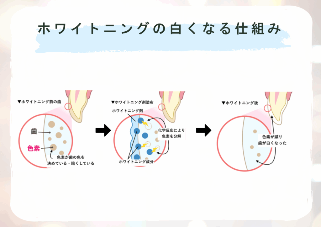 ホワイトニングの白くなる仕組み
