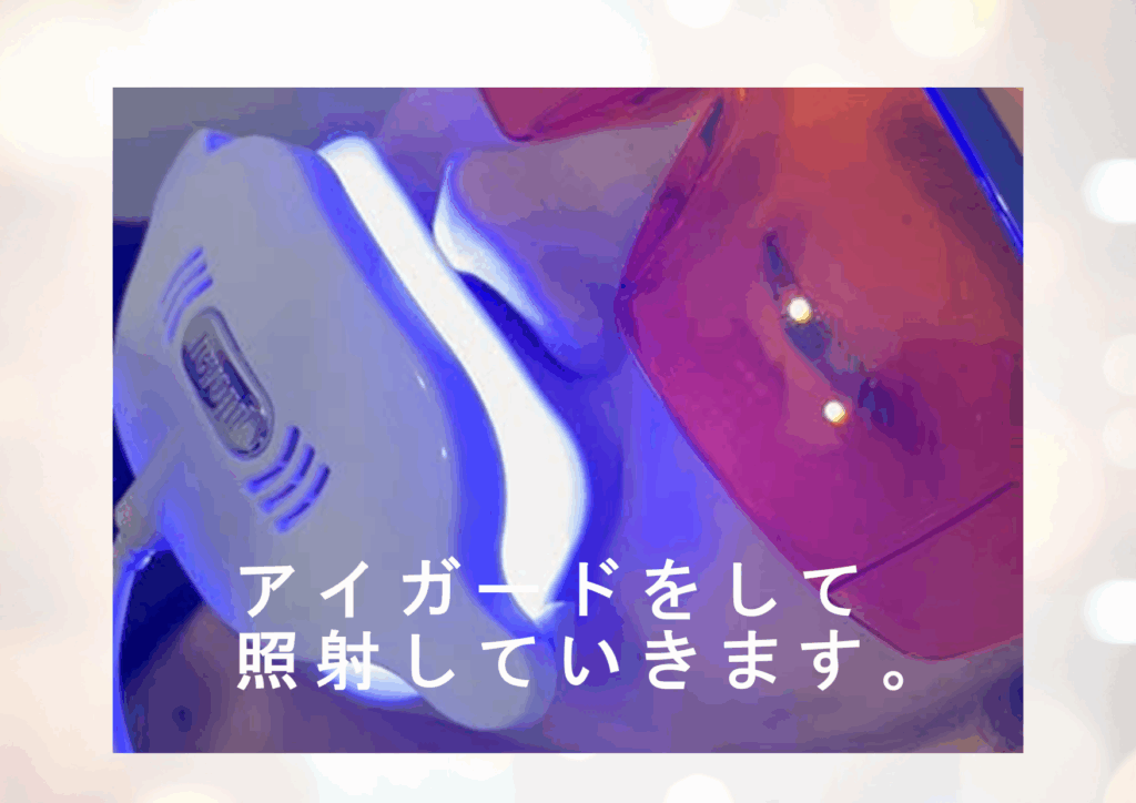 アイガードをして照射していきます