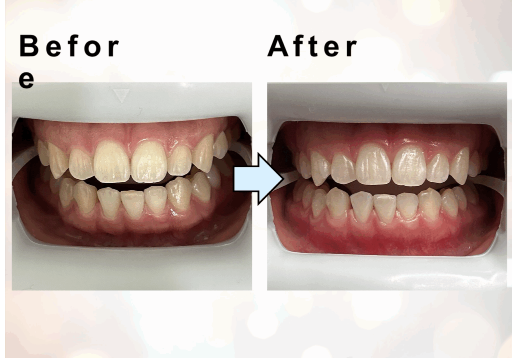 Before
After